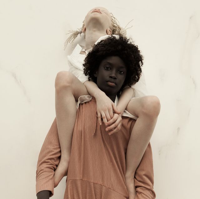 アルビノの子どもと女性