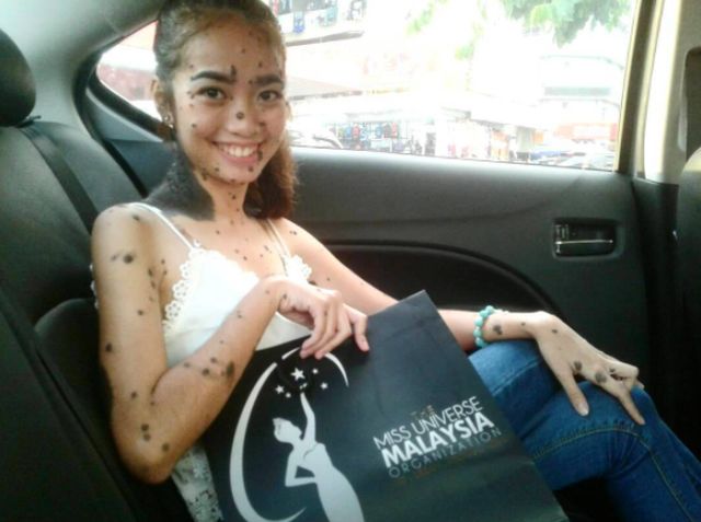 いじめを乗り越えミス・ユニバースに挑戦　Evita Delmundoさん